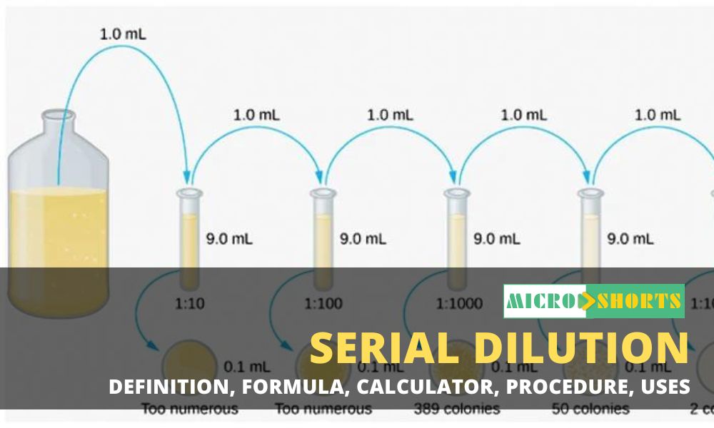 Serial Dilution- Definition, Formula, Calculator, Procedure, Uses