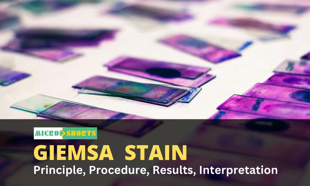 Giemsa Stain- Principle, Procedure, Results, Interpretation