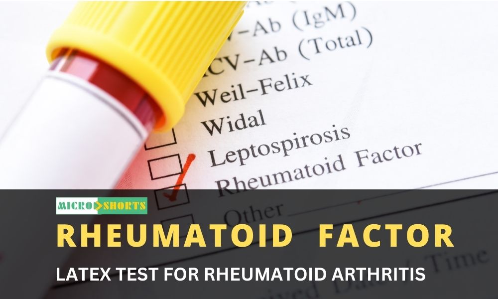 LATEX TEST FOR RHEUMATOID ARTHRITIS [RHEUMATOID  FACTOR]