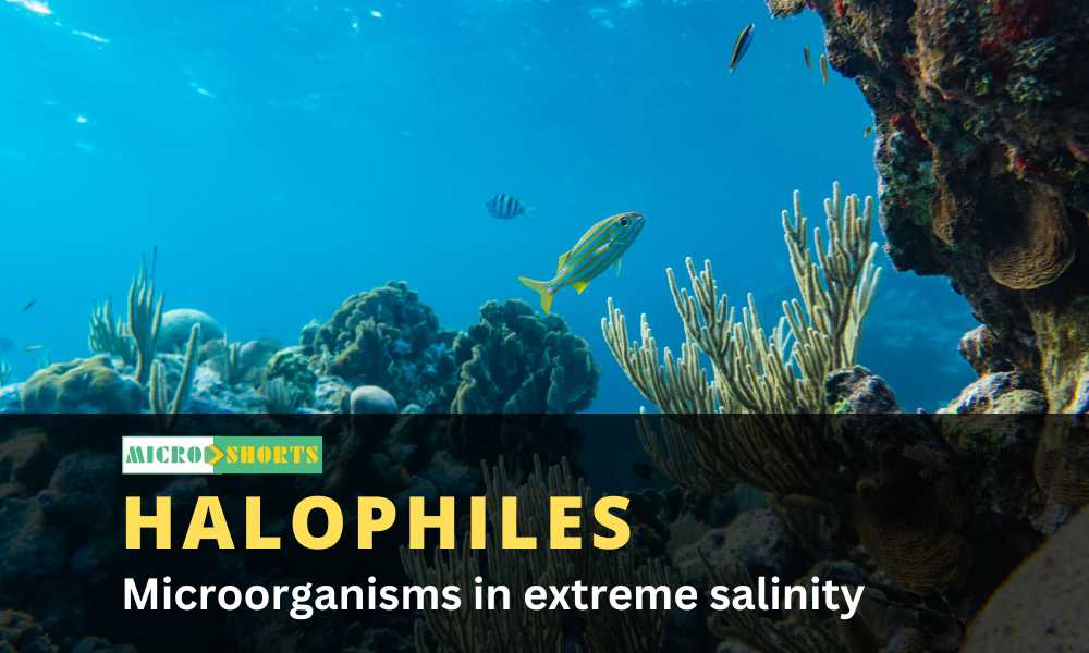 Microorganisms in extreme salinity (Halophiles)