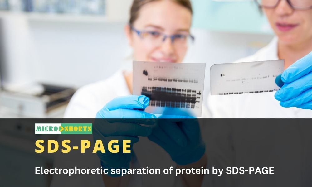 Electrophoretic separation of protein by SDS-PAGE