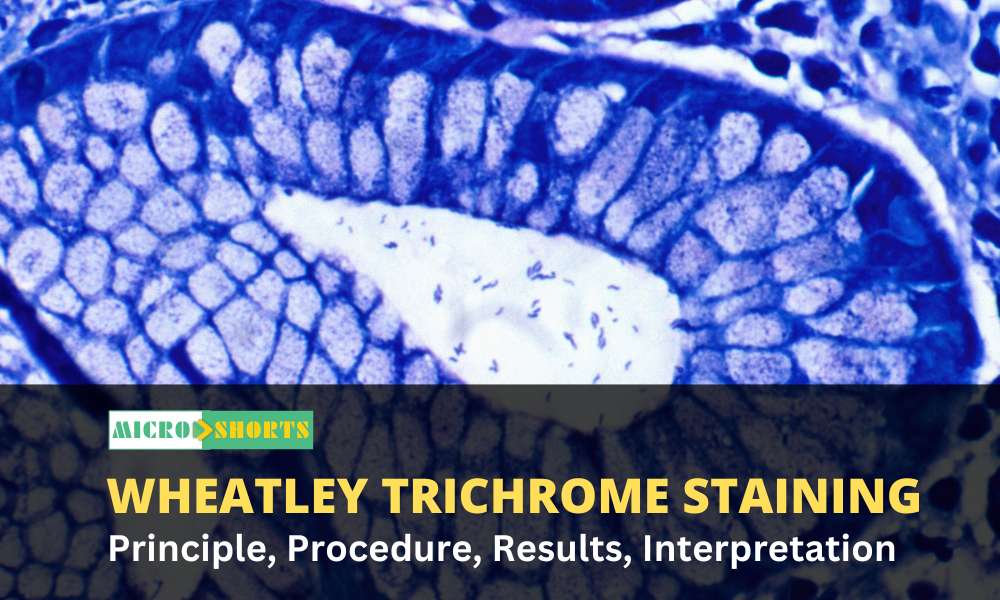 Wheatley Trichrome Staining