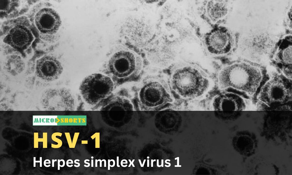 Herpes simplex virus 1 (HSV-1)