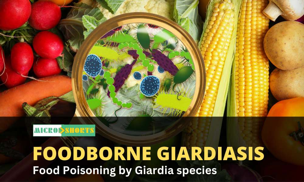 Foodborne Giardiasis- Food Poisoning by Giardia species