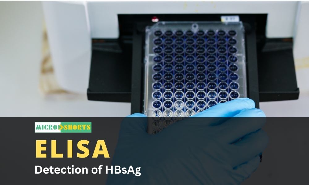 ELISA Detection of HBsAg
