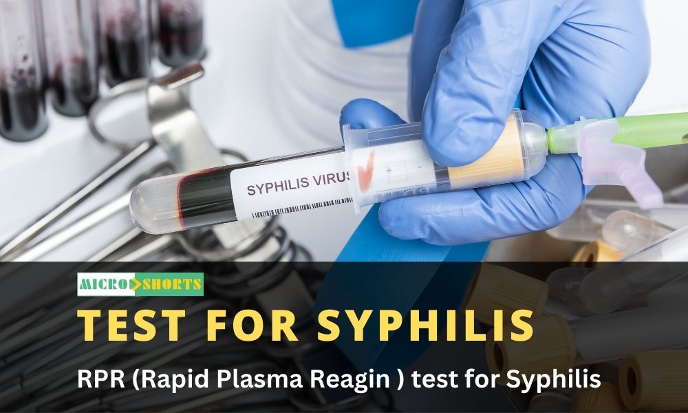 RPR (Rapid Plasma Reagin ) test for Syphilis