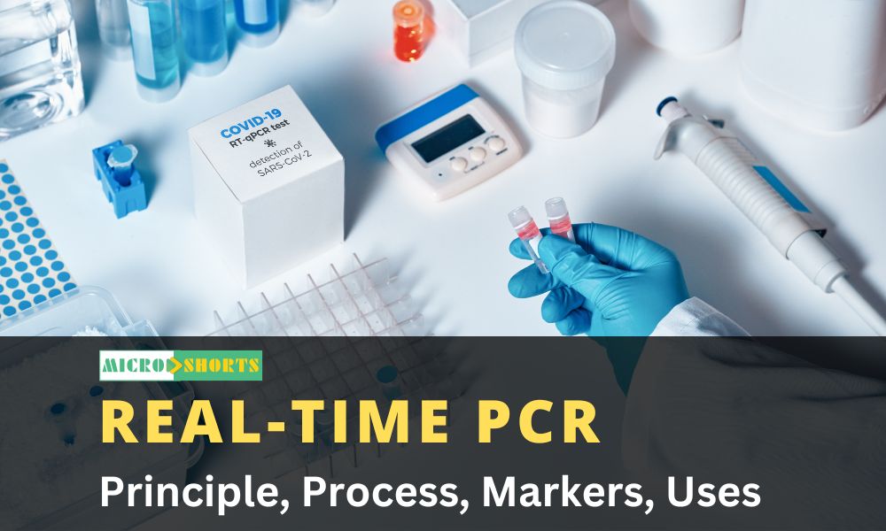 Real-Time PCR: Principle, Process, Markers, Uses