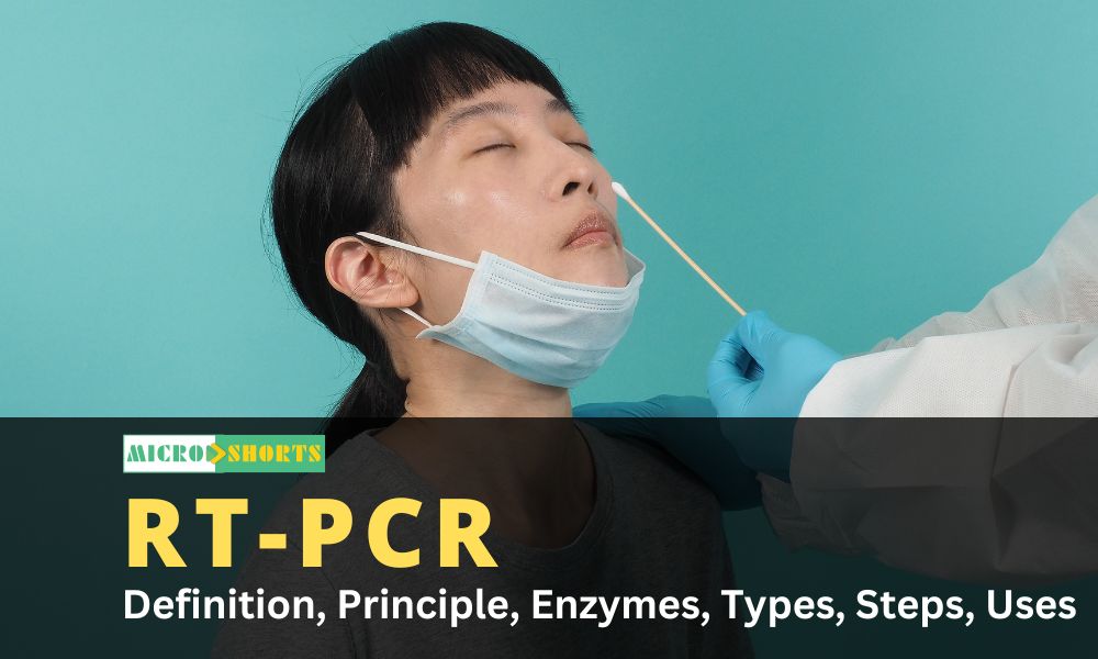RT-PCR: Definition, Principle, Enzymes, Types, Steps, Uses