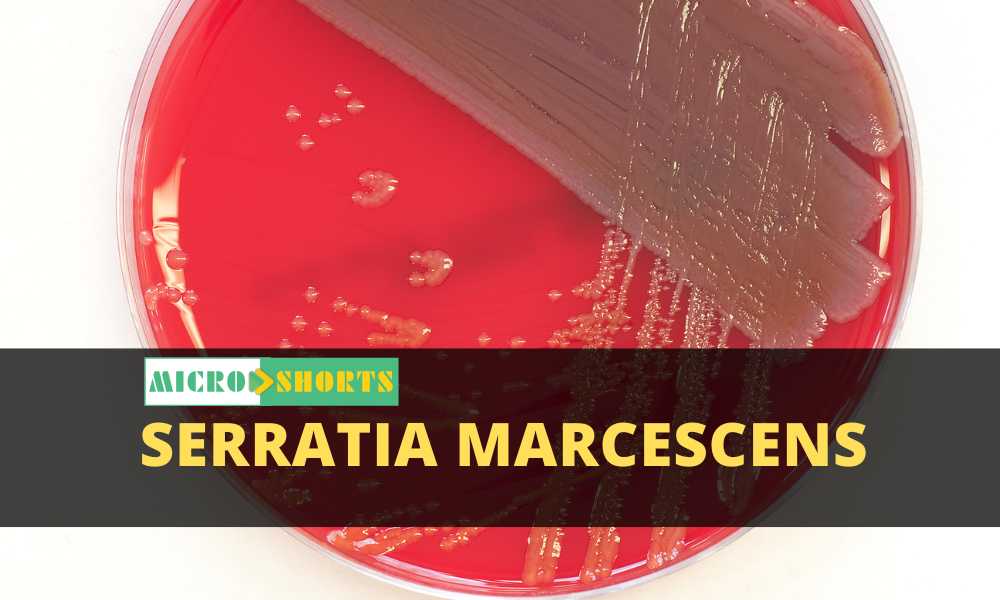 Serratia marcescens- An Overview