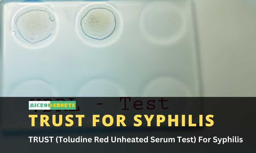 TRUST (Toludine Red Unheated Serum Test) For Syphilis