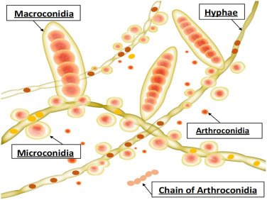 Microsporum.jpg